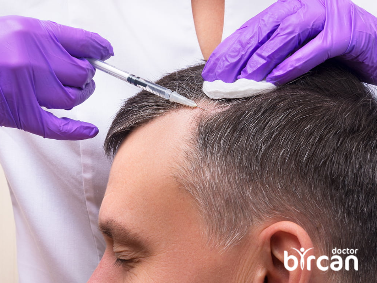 How Does Hair Loss Occur?