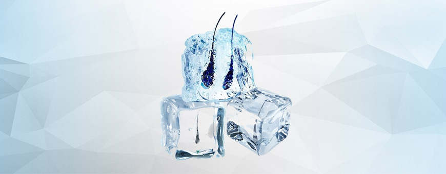 ice grafts hair transplant
