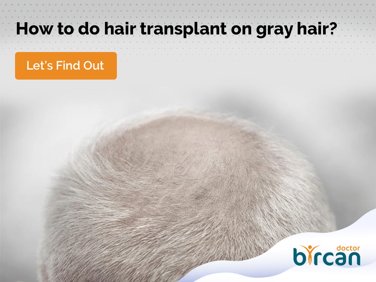 gray hair transplant