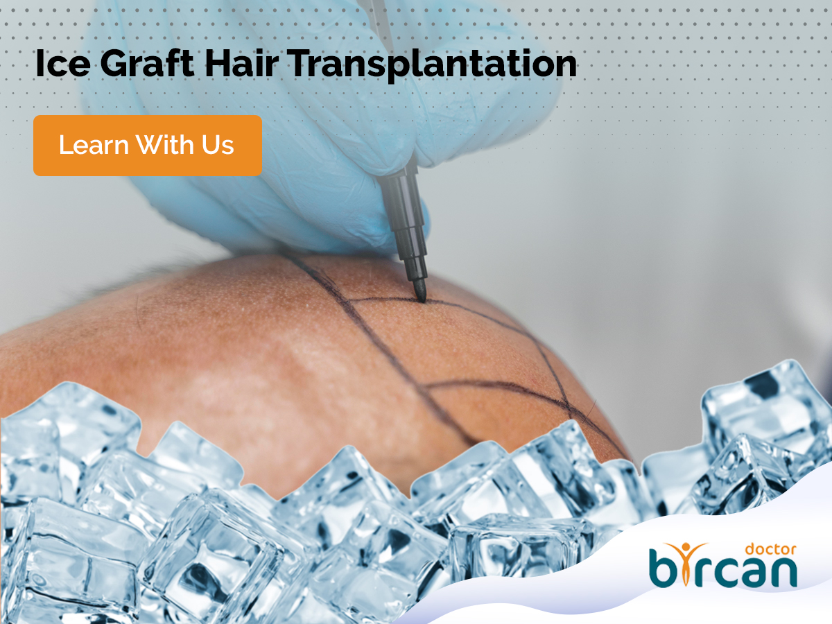 ice graft hair transplantation