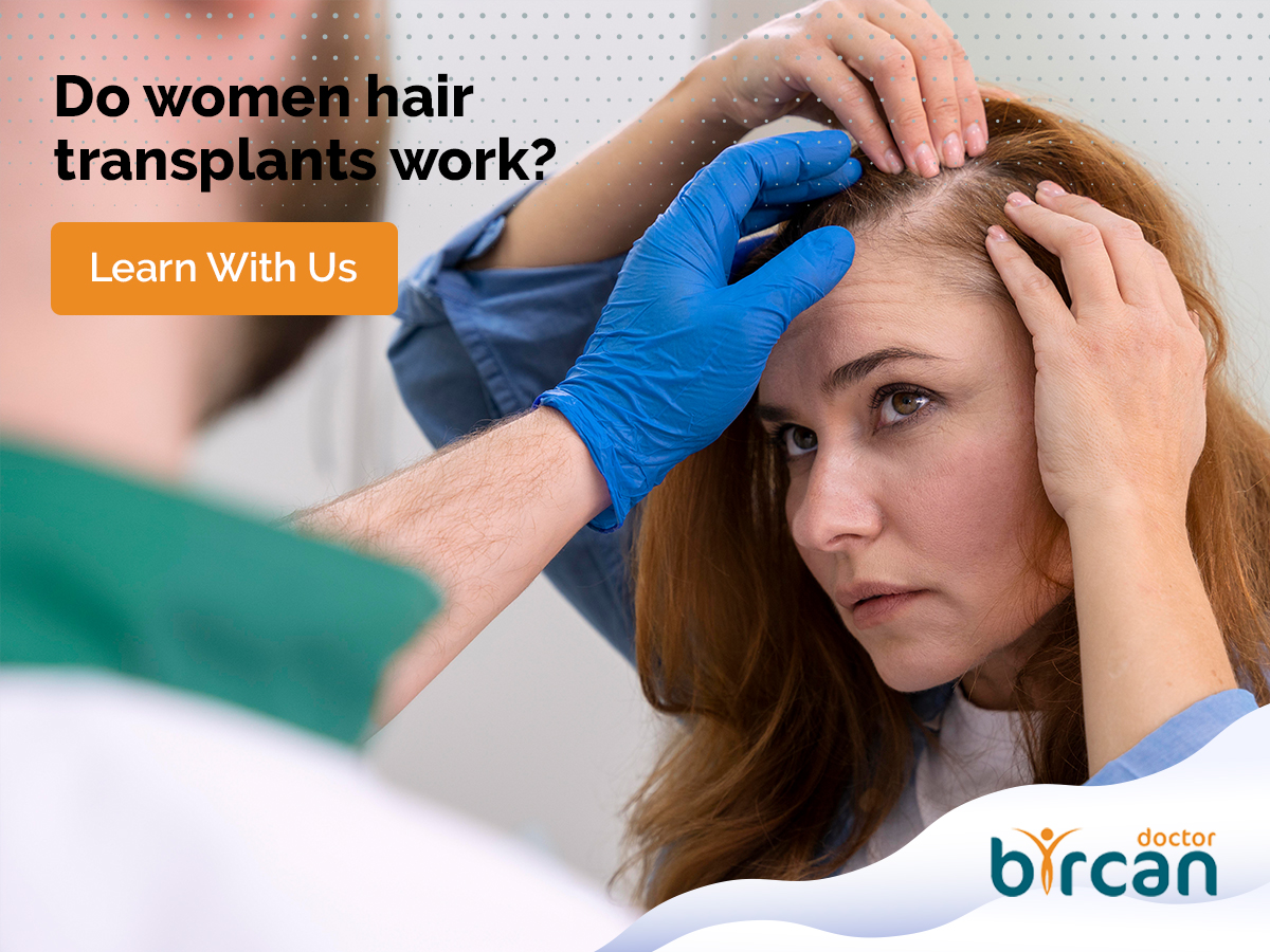 Do Women Hair Transplants Work? » Dr. Gökhan Bircan