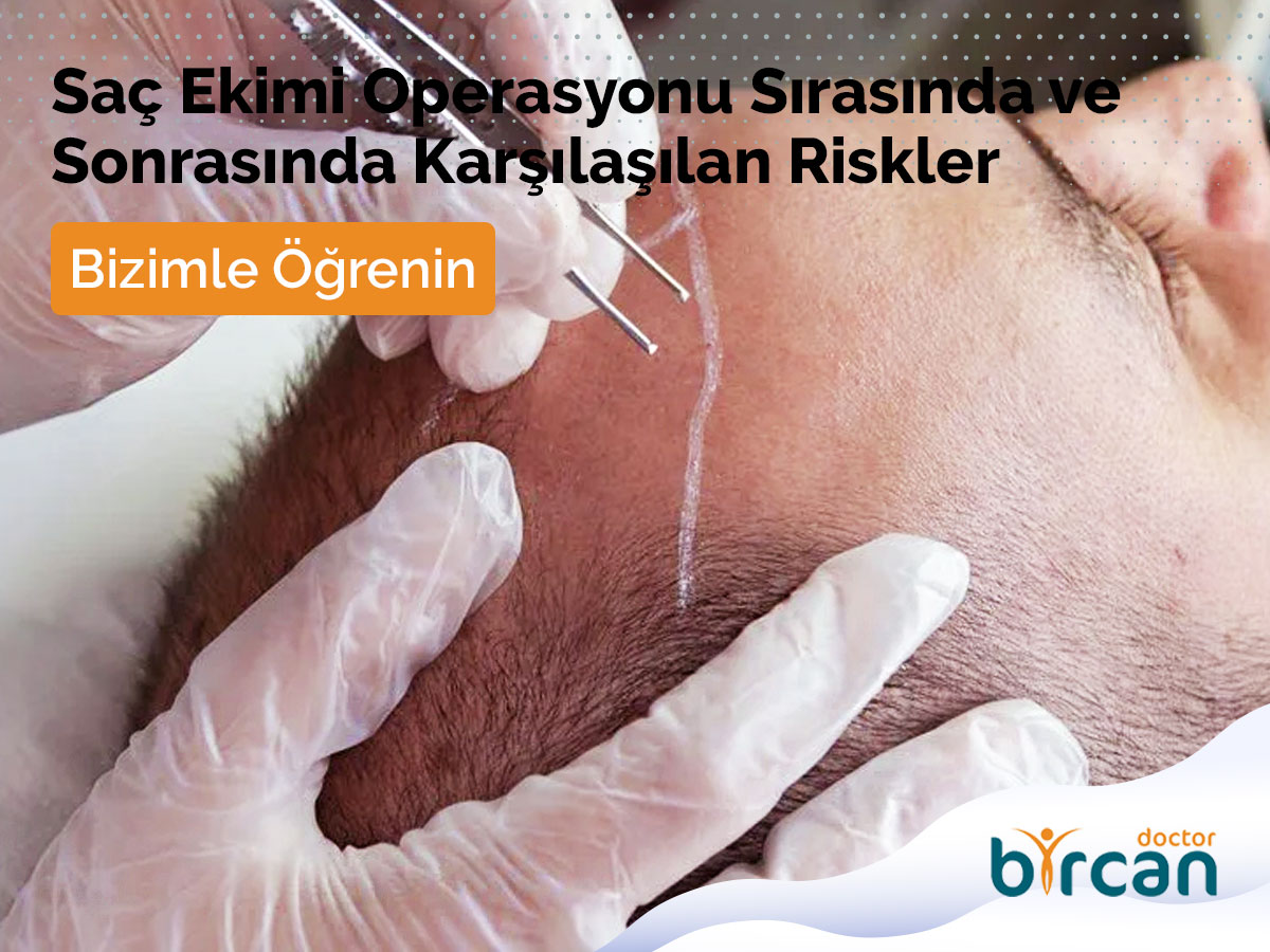 Saç Ekimi Operasyonu Sırasında ve Sonrasında Karşılaşılan Riskler