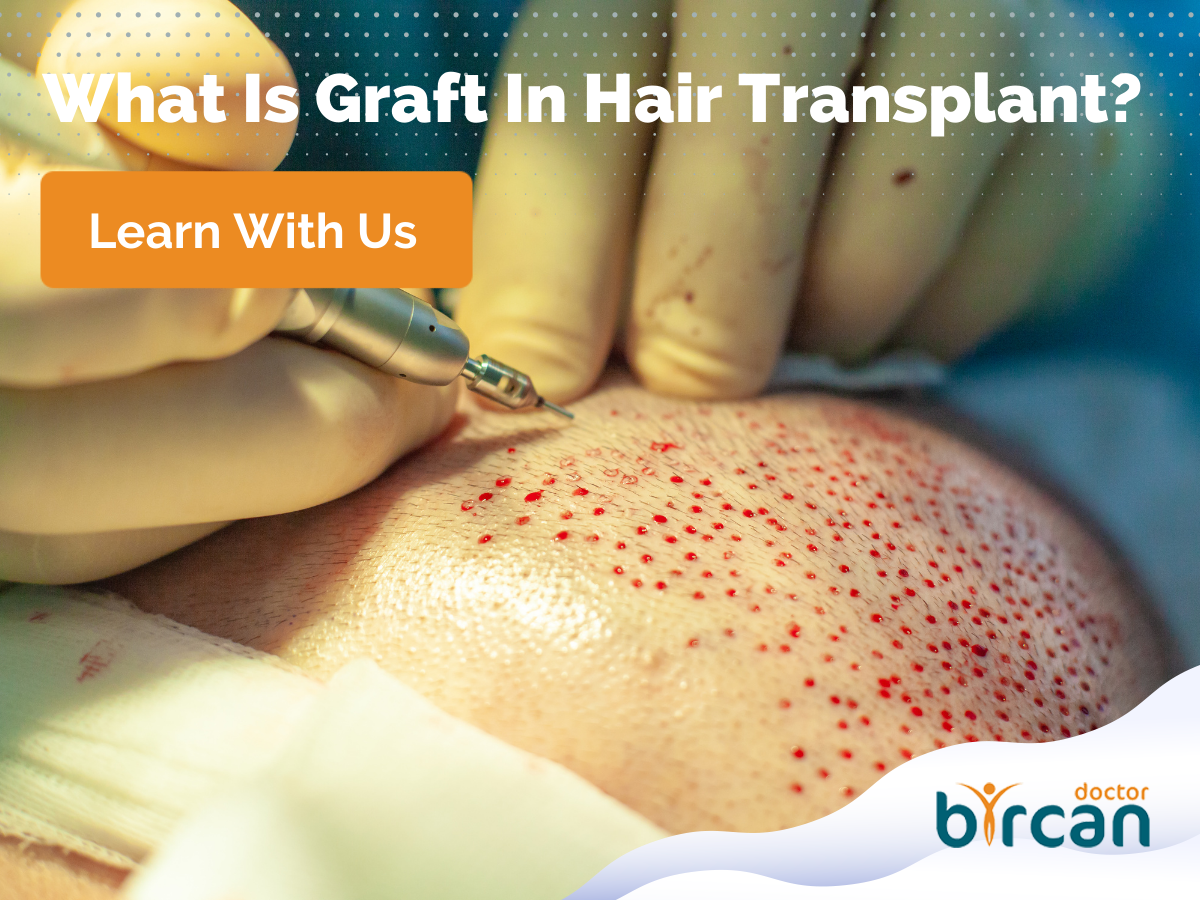 What Is Graft In Hair Transplant