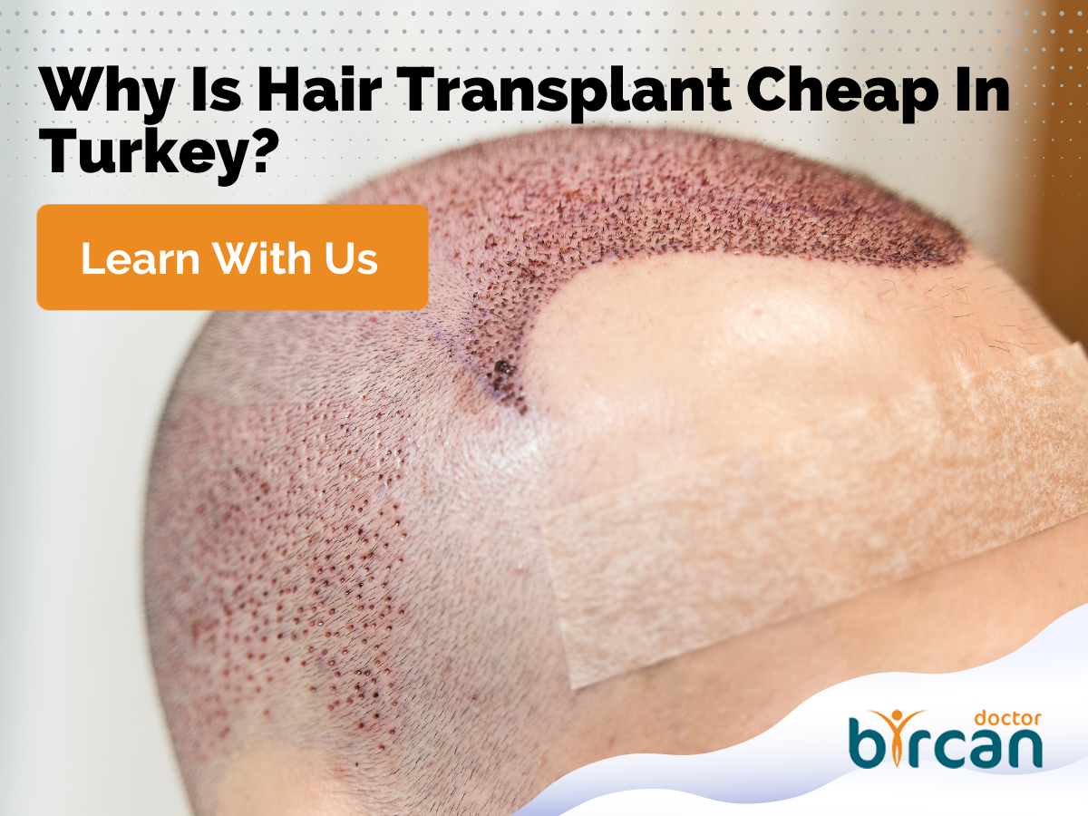 Why Is Hair Transplant Cheap In Turkey