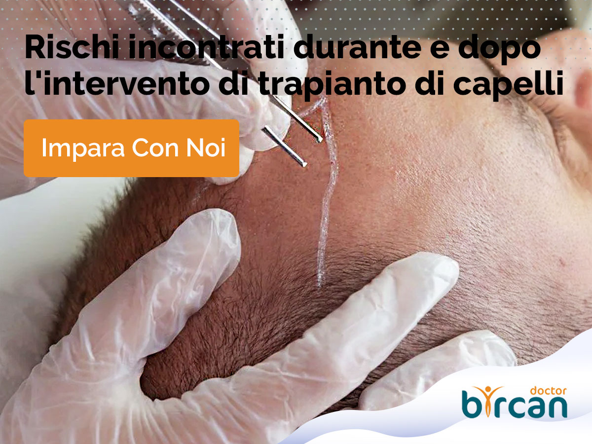 Rischi incontrati durante e dopo l'intervento di trapianto di capelli