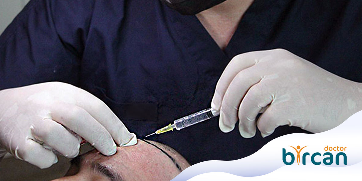 When To Get A Hair Transplant?