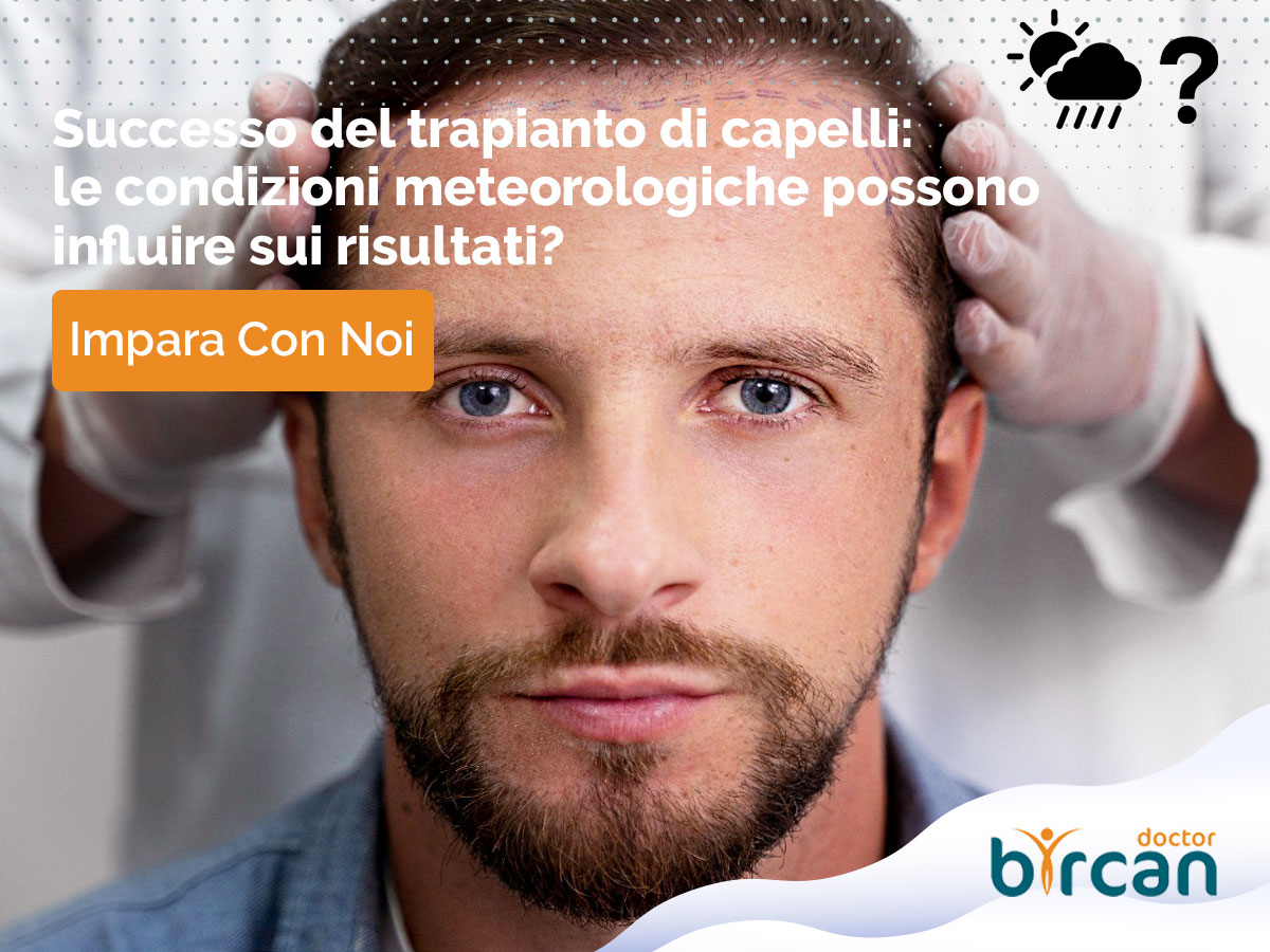 Successo del trapianto di capelli: le condizioni meteorologiche possono influire sui risultati?