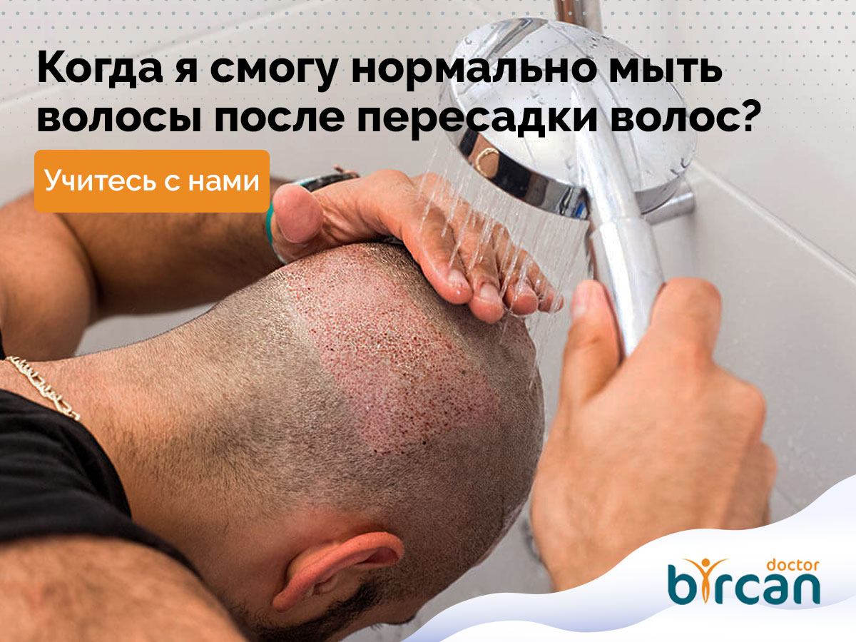 Когда я смогу нормально мыть волосы после пересадки волос?