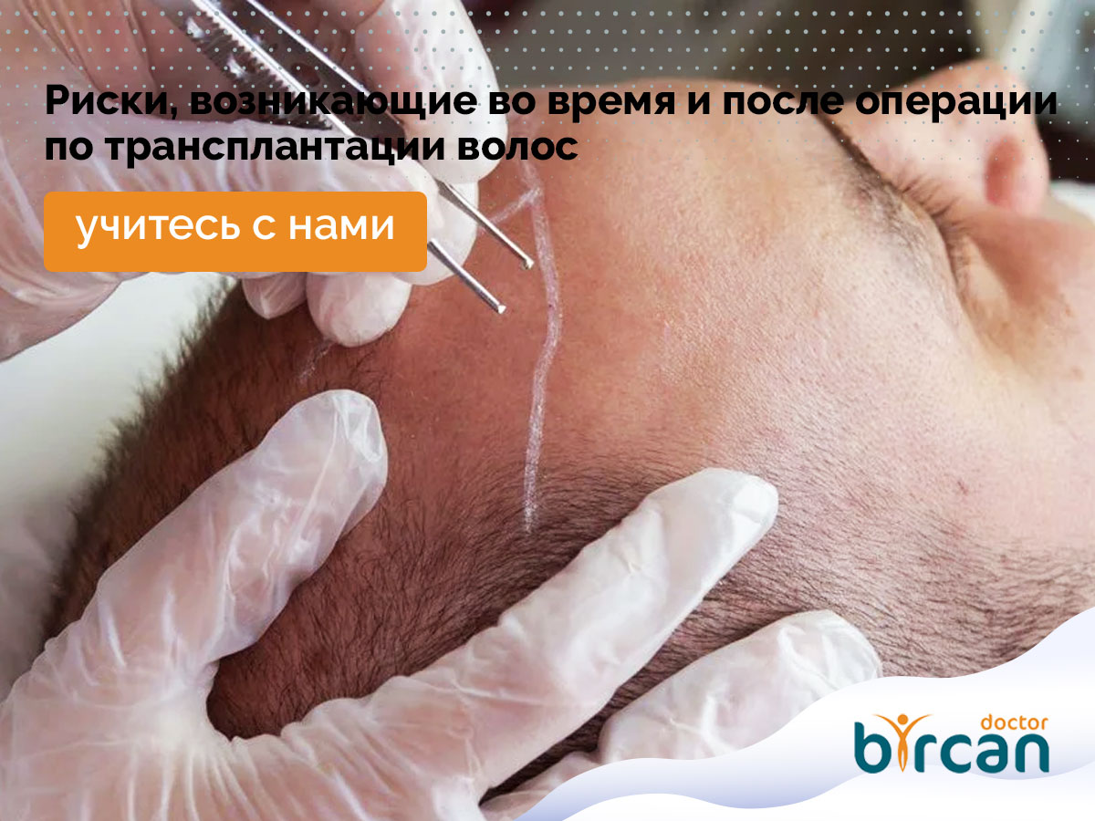 Риски, возникающие во время и после операции по трансплантации волос